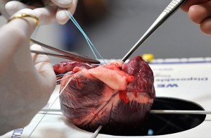 Эксперимент по пересадке сердца свиньи бабуину