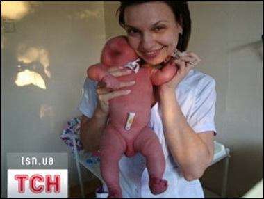В Днепропетровске две медсестры устроили скандальную фотосессию с недоношенными младенцами